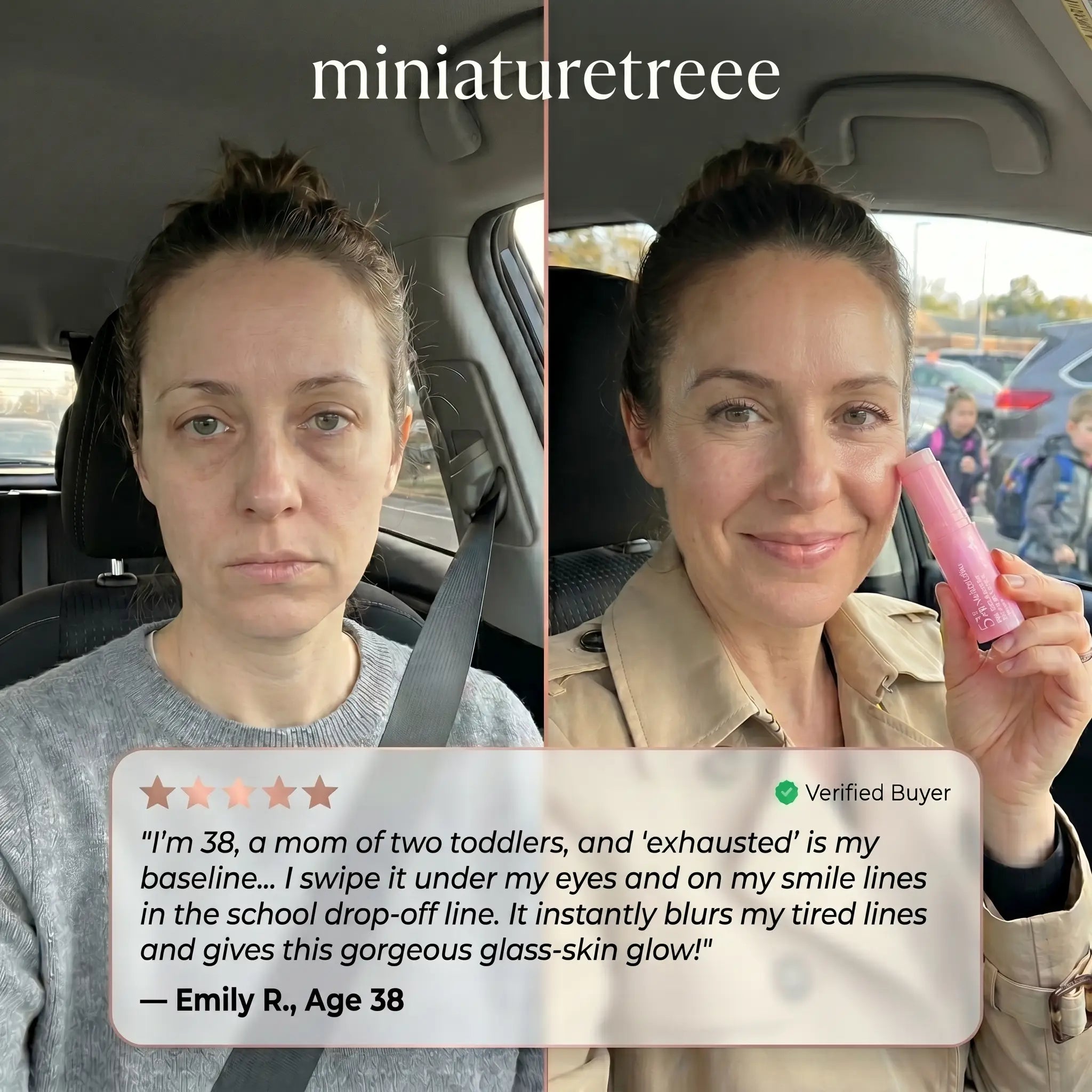 Miniature Tree™ 5% Volufiline Pink Volume Balm - Instant Needle-Free Plump & 24/7 Radiant Glow | Last Day Claim 90% OFF 🔥
