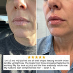 Miniaturetreee™ Bio-Spicule Plumping Lip Serum - Instant Natural Plump & 24/7 Glass-Like Hydration | Last Day Claim 90% OFF 🔥